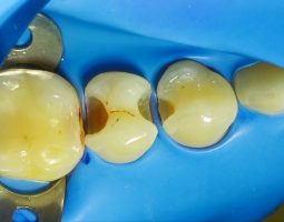 Д-р Росица Кокудева